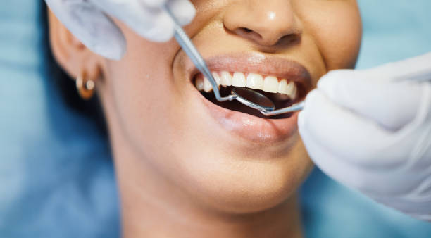 Best Emergency Dentist for Knocked-Out Tooth in Ravena, NY